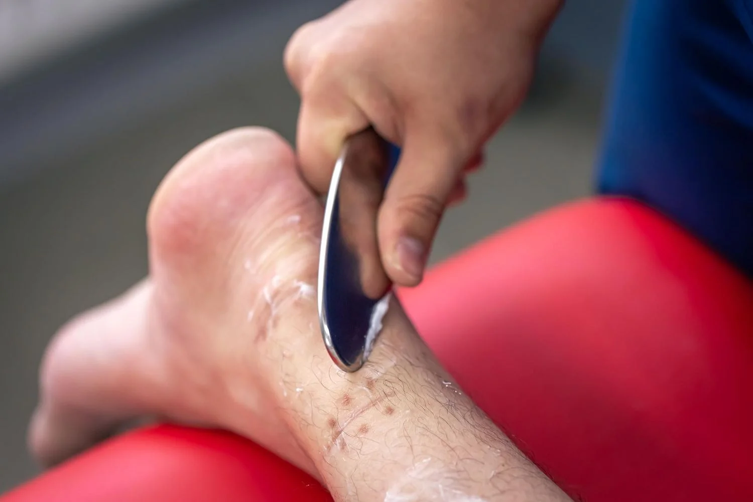 Scar Tissue: What It Actually Is, What It Isn’t, and What PT Does About It