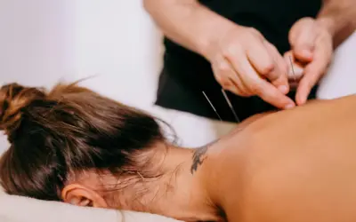 What Is Dry Needling? A Modern Approach to Pain Relief & Performance at Aureum Physio
